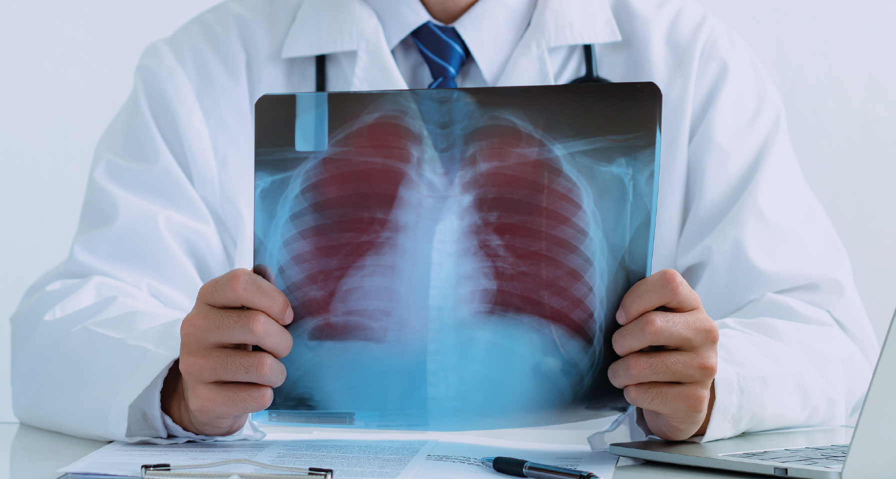 Cáncer de pulmón