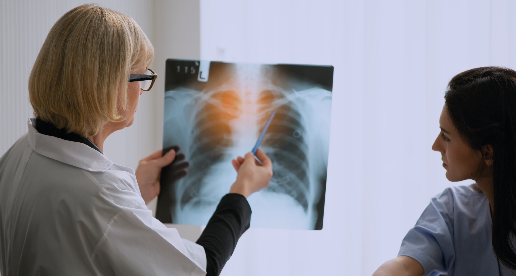Cáncer de pulmón